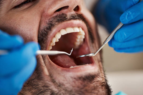 Full Mouth Reconstruction in New Albany, IN